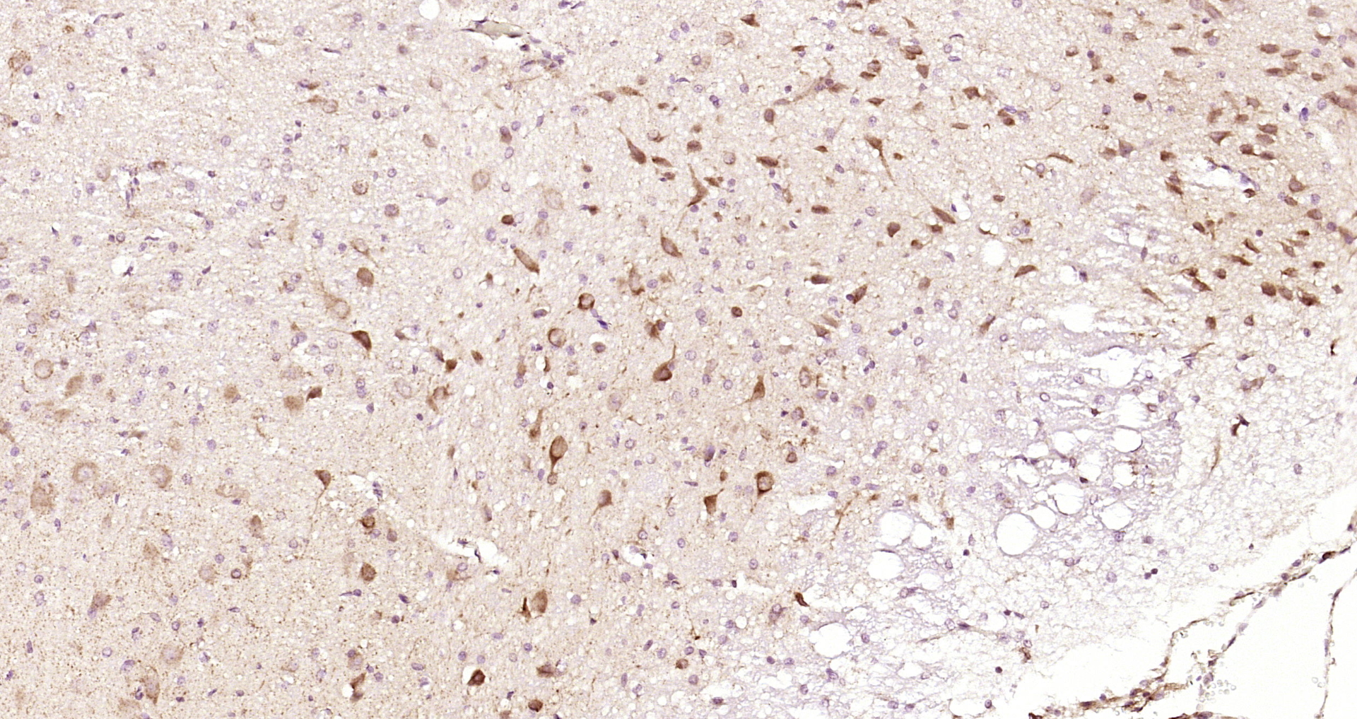 Paraformaldehyde-fixed, paraffin embedded Rat brain; Antigen retrieval by boiling in sodium citrate buffer (pH6.0) for 15min; Block endogenous peroxidase by 3% hydrogen peroxide for 20 minutes; Blocking buffer (normal goat serum) at 37°C for 30min; Antibody incubation with SAFB Polyclonal Antibody, Unconjugated (bs-17259R) at 1:200 overnight at 4°C, DAB staining.