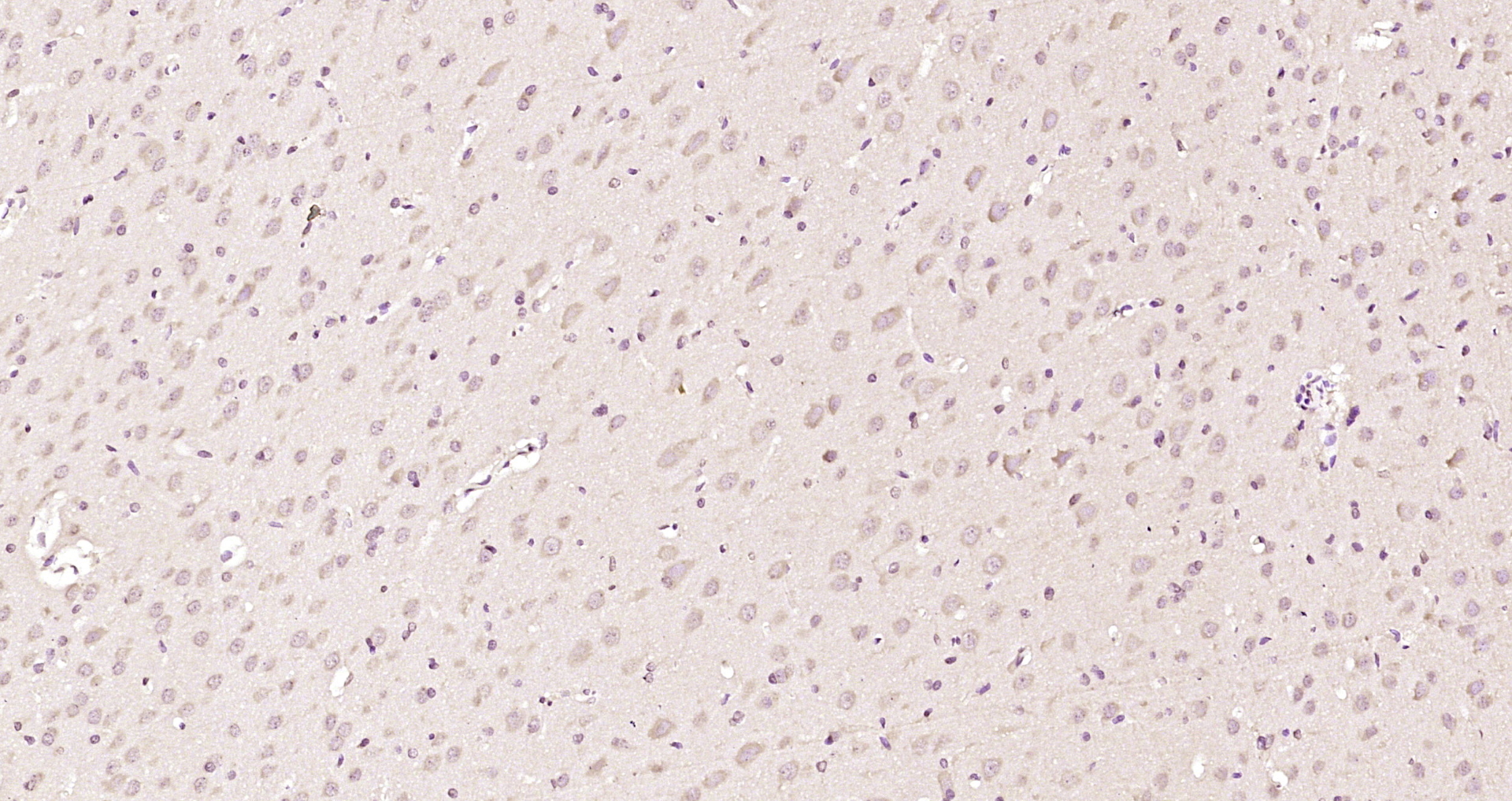 Paraformaldehyde-fixed, paraffin embedded Rat brain; Antigen retrieval by boiling in sodium citrate buffer (pH6.0) for 15min; Block endogenous peroxidase by 3% hydrogen peroxide for 20 minutes; Blocking buffer (normal goat serum) at 37°C for 30min; Antibody incubation with Topoisomerase II beta Polyclonal Antibody, Unconjugated (bs-17324R) at 1:200 overnight at 4°C, DAB staining.