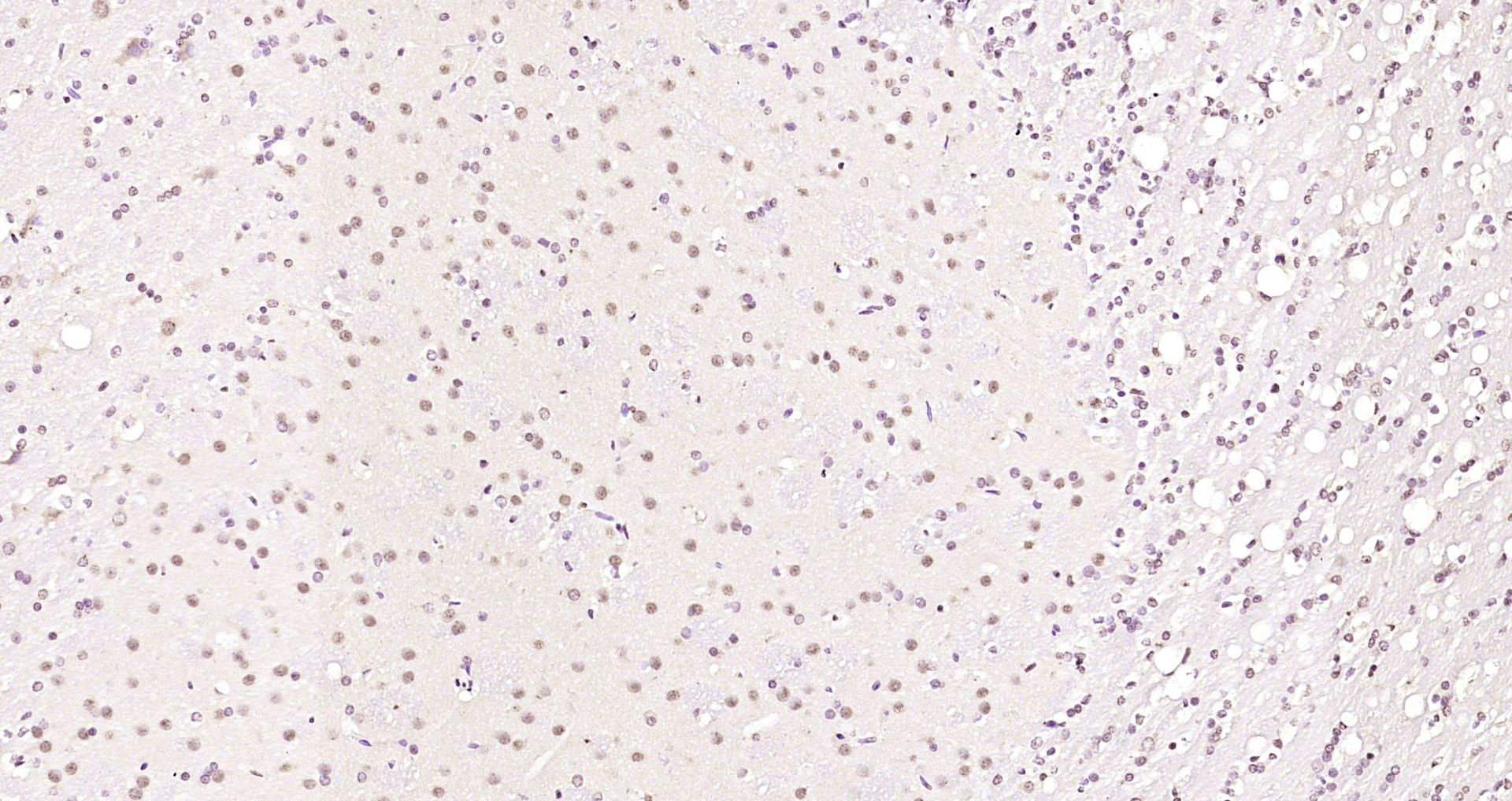 Paraformaldehyde-fixed, paraffin embedded Rat brain; Antigen retrieval by boiling in sodium citrate buffer (pH6.0) for 15min; Block endogenous peroxidase by 3% hydrogen peroxide for 20 minutes; Blocking buffer (normal goat serum) at 37°C for 30min; Antibody incubation with hnRNP M1-M4 Polyclonal Antibody, Unconjugated (bs-17335R) at 1:200 overnight at 4°C, DAB staining.