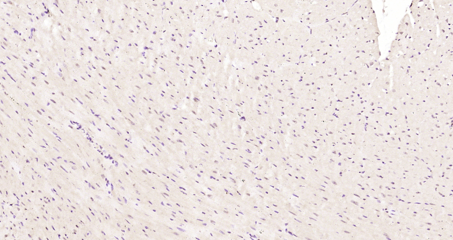 Paraformaldehyde-fixed, paraffin embedded Mouse heart; Antigen retrieval by boiling in sodium citrate buffer (pH6.0) for 15min; Block endogenous peroxidase by 3% hydrogen peroxide for 20 minutes; Blocking buffer (normal goat serum) at 37°C for 30min; Antibody incubation with hnRNP M1-M4 Polyclonal Antibody, Unconjugated (bs-17335R) at 1:200 overnight at 4°C, DAB staining.