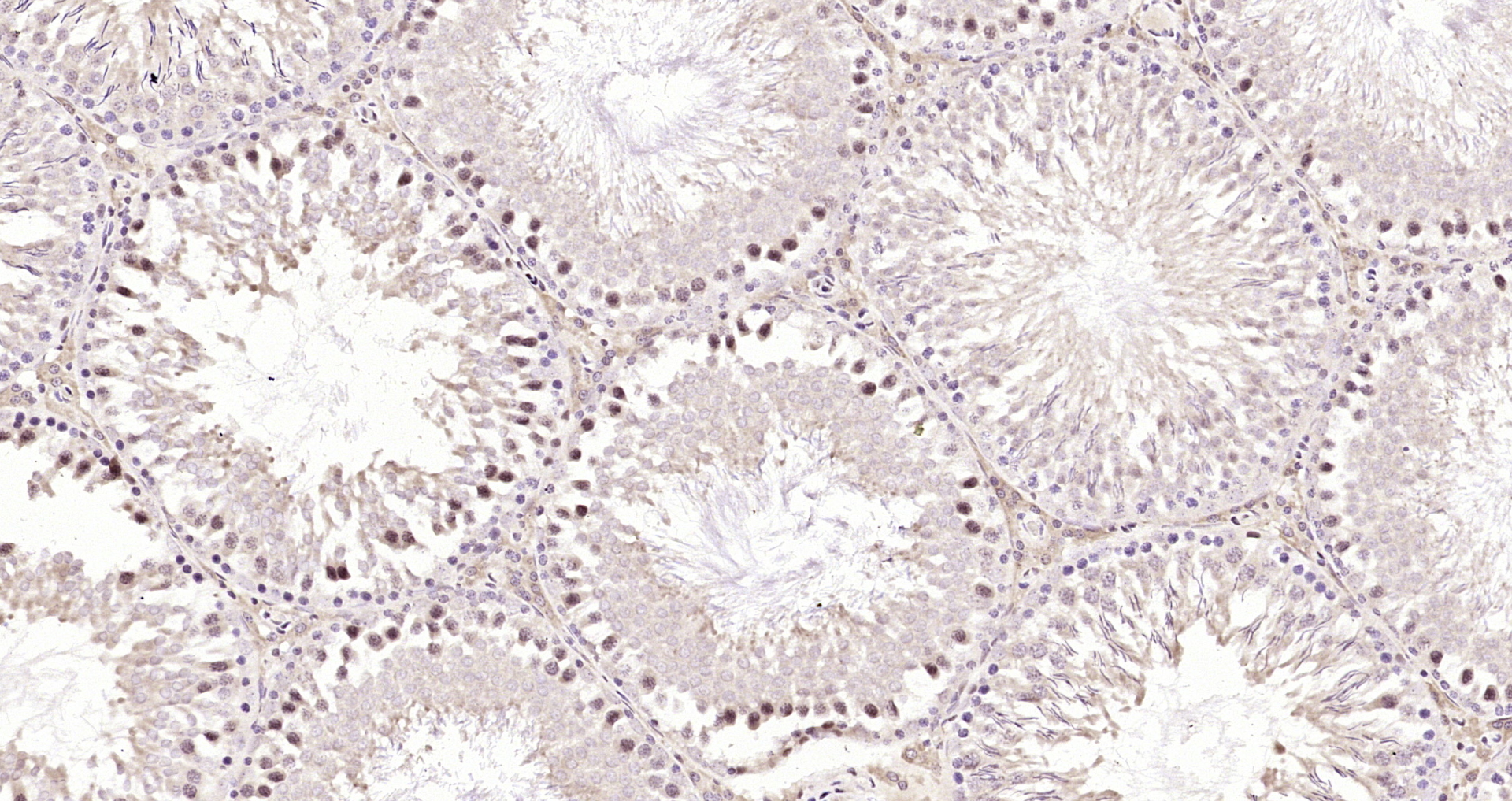 Paraformaldehyde-fixed, paraffin embedded Rat testis; Antigen retrieval by boiling in sodium citrate buffer (pH6.0) for 15min; Block endogenous peroxidase by 3% hydrogen peroxide for 20 minutes; Blocking buffer (normal goat serum) at 37°C for 30min; Antibody incubation with METTL3 Polyclonal Antibody, Unconjugated (bs-17609R) at 1:200 overnight at 4°C, DAB staining.