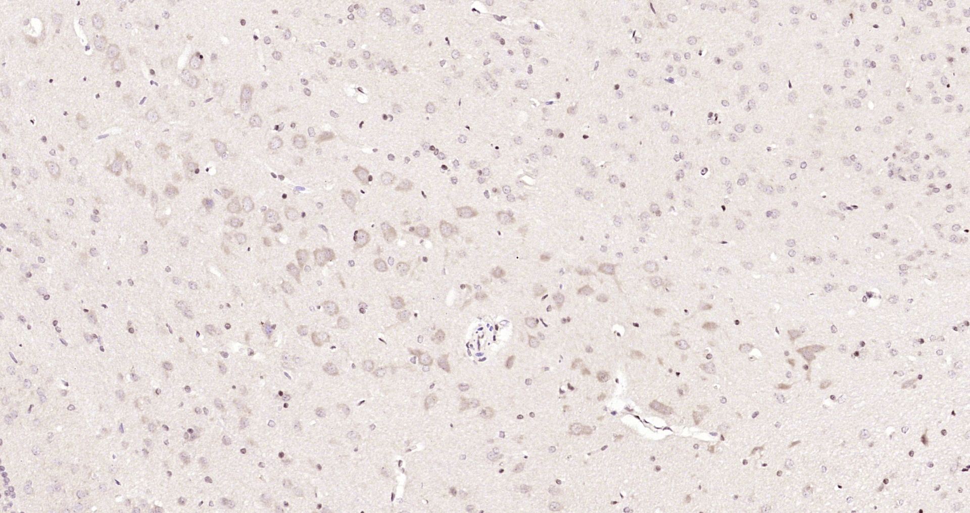Paraformaldehyde-fixed, paraffin embedded Rat brain; Antigen retrieval by boiling in sodium citrate buffer (pH6.0) for 15min; Block endogenous peroxidase by 3% hydrogen peroxide for 20 minutes; Blocking buffer (normal goat serum) at 37°C for 30min; Antibody incubation with METTL3 Polyclonal Antibody, Unconjugated (bs-17609R) at 1:200 overnight at 4°C, DAB staining. Paraformaldehyde-fixed, paraffin embedded Rat brain; Antigen retrieval by boiling in sodium citrate buffer (pH6.0) for 15min; Block endogenous peroxidase by 3% hydrogen peroxide for 20 minutes; Blocking buffer (normal goat serum) at 37°C for 30min; Antibody incubation with METTL3 Polyclonal Antibody, Unconjugated (bs-17609R) at 1:200 overnight at 4°C, DAB staining.