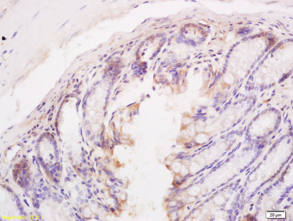 Formalin-fixed and paraffin embedded mouse intestine tissue labeled with Anti BIM\/BCL2L11 Polyclonal Antibody, Unconjugated (bs-1488R) at 1:200 followed by conjugation to the secondary antibody and DAB staining