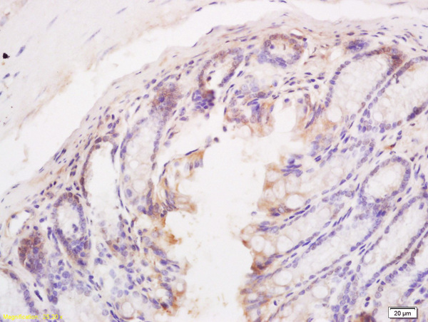 Formalin-fixed and paraffin embedded mouse intestine tissue labeled with Anti BIM/BCL2L11 Polyclonal Antibody, Unconjugated (bs-1488R) at 1:200 followed by conjugation to the secondary antibody and DAB staining