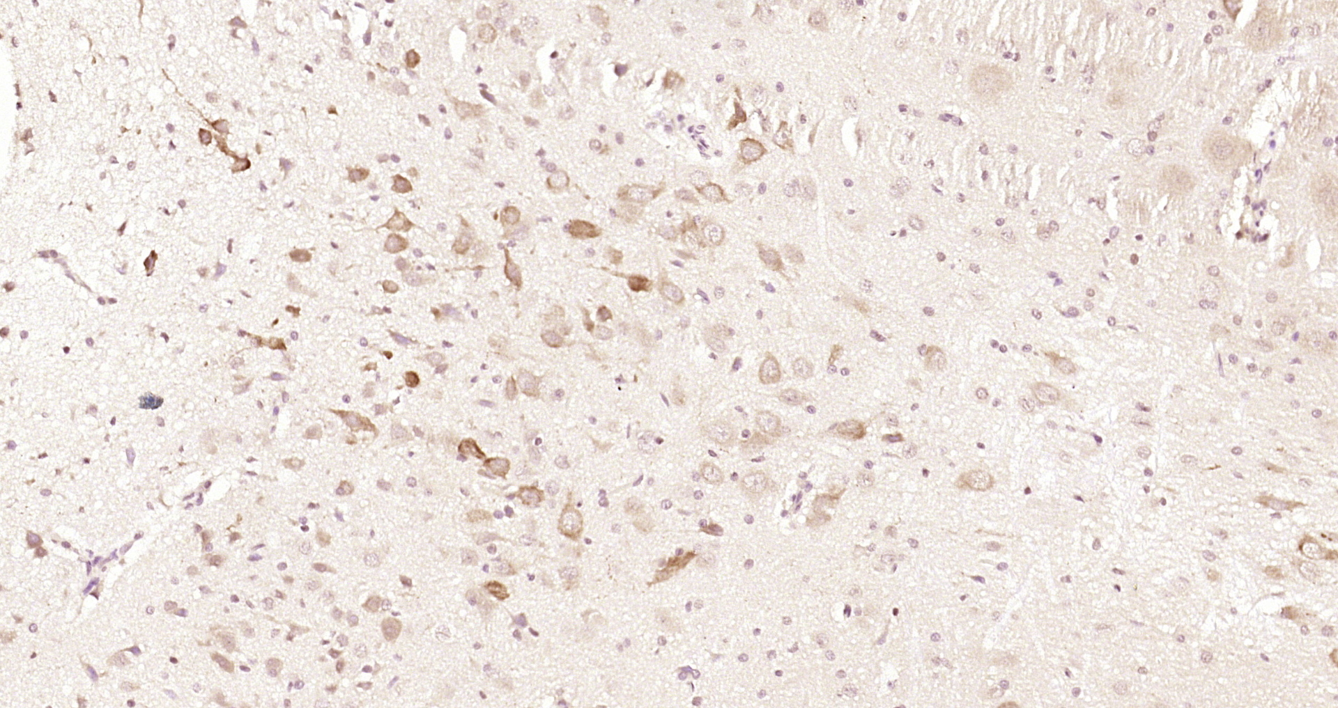 Paraformaldehyde-fixed, paraffin embedded Rat brain; Antigen retrieval by boiling in sodium citrate buffer (pH6.0) for 15min; Block endogenous peroxidase by 3% hydrogen peroxide for 20 minutes; Blocking buffer (normal goat serum) at 37°C for 30min; Antibody incubation with SPRED2 Polyclonal Antibody, Unconjugated (bs-17686R) at 1:200 overnight at 4°C, DAB staining. Paraformaldehyde-fixed, paraffin embedded Rat brain; Antigen retrieval by boiling in sodium citrate buffer (pH6.0) for 15min; Block endogenous peroxidase by 3% hydrogen peroxide for 20 minutes; Blocking buffer (normal goat serum) at 37°C for 30min; Antibody incubation with SPRED2 Polyclonal Antibody, Unconjugated (bs-17686R) at 1:200 overnight at 4°C, DAB staining.