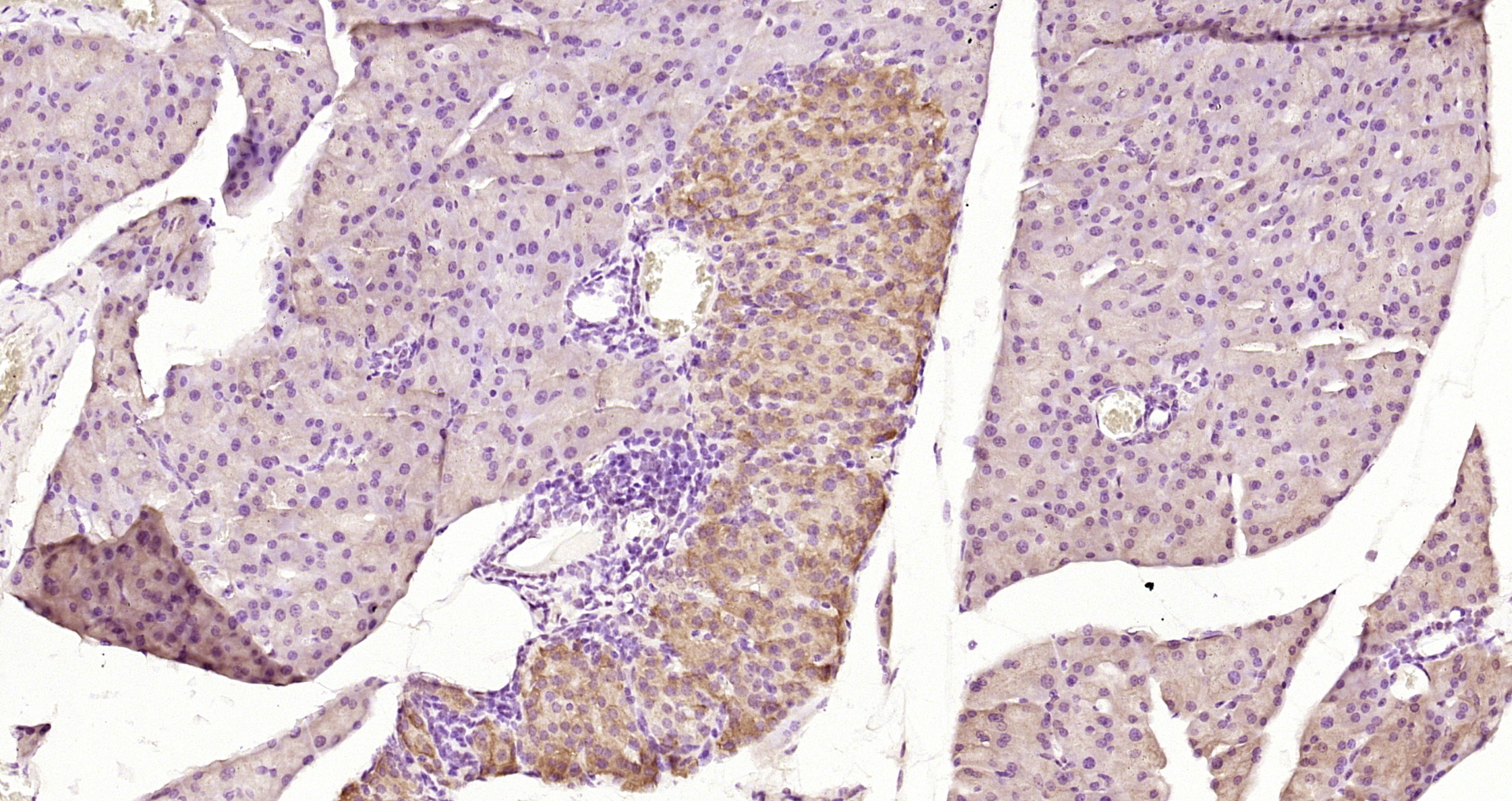 Paraformaldehyde-fixed, paraffin embedded Mouse pancreas; Antigen retrieval by boiling in sodium citrate buffer (pH6.0) for 15min; Block endogenous peroxidase by 3% hydrogen peroxide for 20 minutes; Blocking buffer (normal goat serum) at 37°C for 30min; Antibody incubation with SPRED2 Polyclonal Antibody, Unconjugated (bs-17686R) at 1:200 overnight at 4°C, DAB staining. Paraformaldehyde-fixed, paraffin embedded Mouse pancreas; Antigen retrieval by boiling in sodium citrate buffer (pH6.0) for 15min; Block endogenous peroxidase by 3% hydrogen peroxide for 20 minutes; Blocking buffer (normal goat serum) at 37°C for 30min; Antibody incubation with SPRED2 Polyclonal Antibody, Unconjugated (bs-17686R) at 1:200 overnight at 4°C, DAB staining.