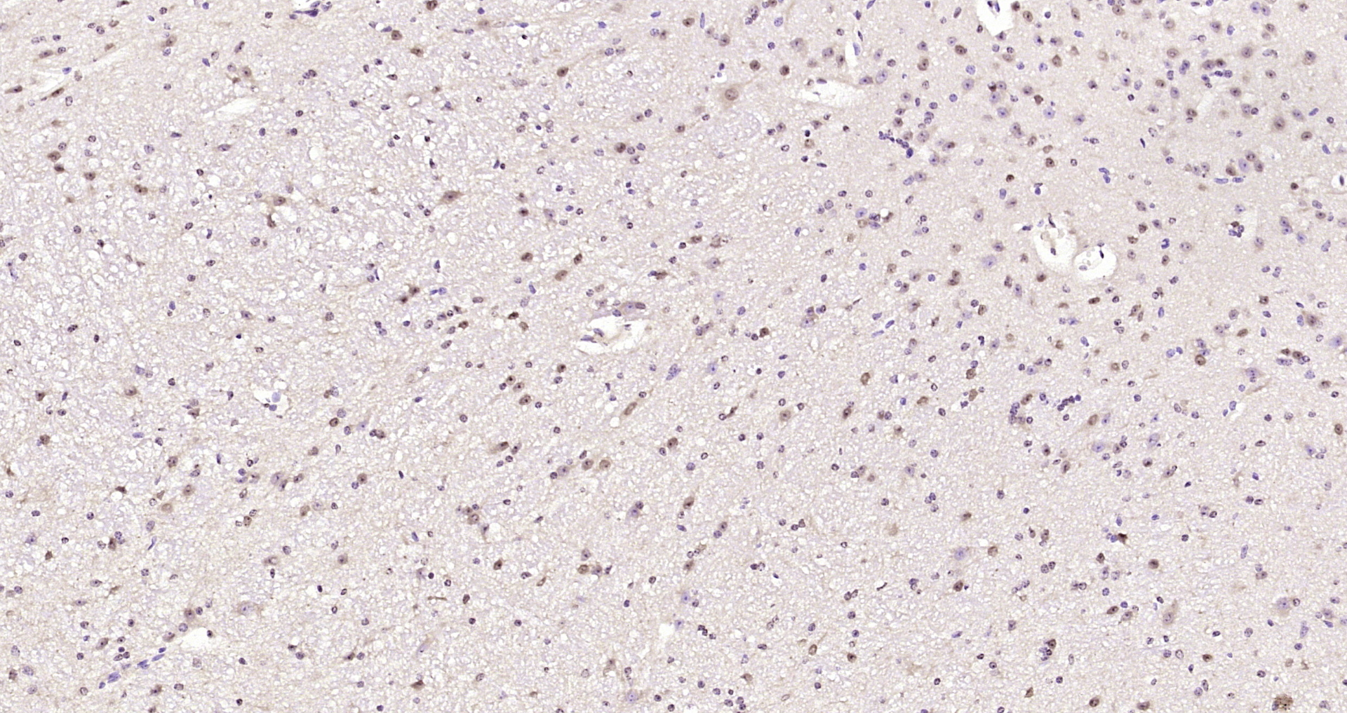 Paraformaldehyde-fixed, paraffin embedded Mouse cerebellum; Antigen retrieval by boiling in sodium citrate buffer (pH6.0) for 15min; Block endogenous peroxidase by 3% hydrogen peroxide for 20 minutes; Blocking buffer (normal goat serum) at 37°C for 30min; Antibody incubation with HSPA4L Polyclonal Antibody, Unconjugated (bs-18082R) at 1:200 overnight at 4°C, DAB staining.