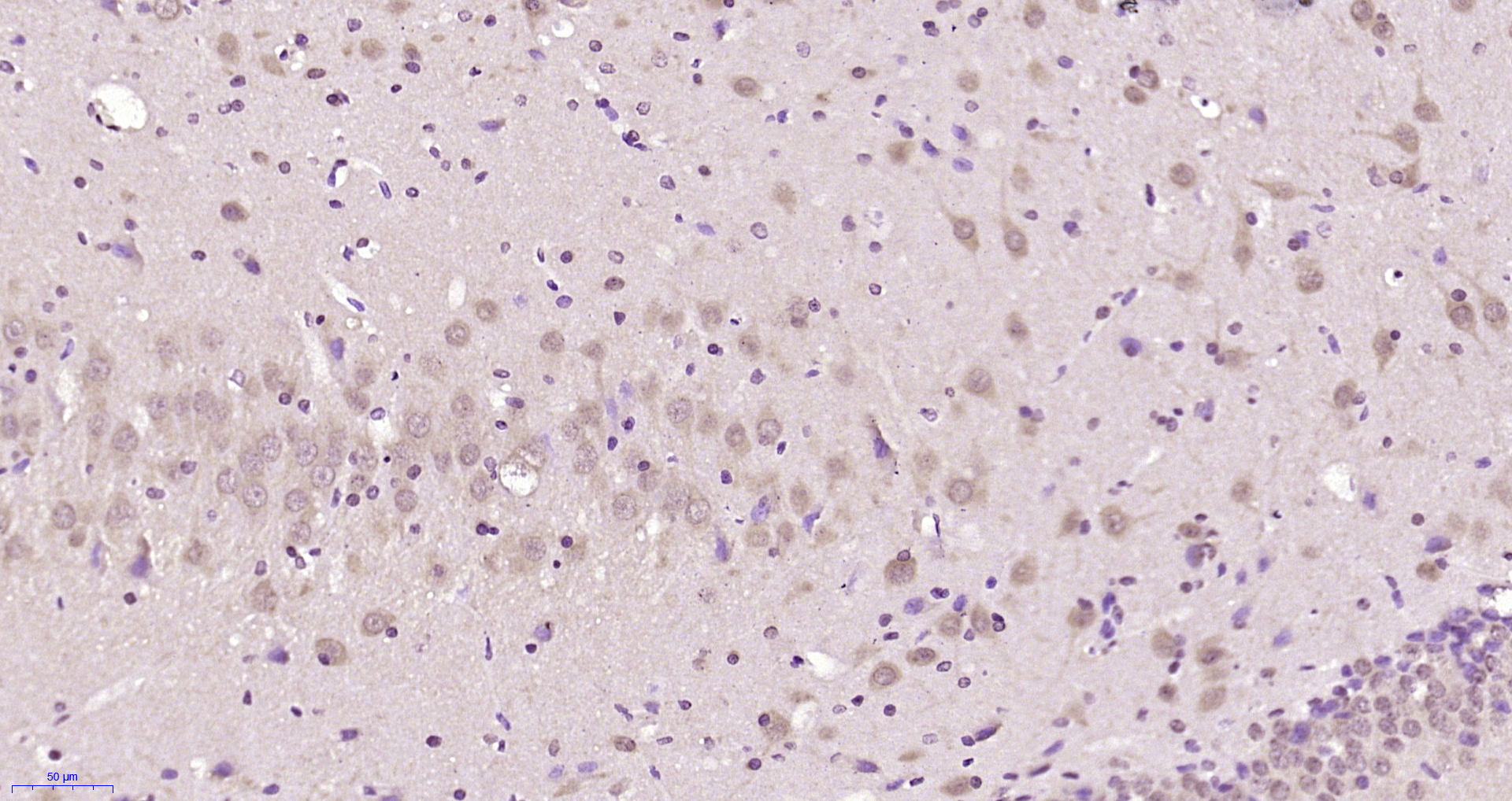 Paraformaldehyde-fixed, paraffin embedded Rat brain; Antigen retrieval by boiling in sodium citrate buffer (pH6.0) for 15min; Block endogenous peroxidase by 3% hydrogen peroxide for 20 minutes; Blocking buffer (normal goat serum) at 37°C for 30min; Antibody incubation with HspBP1 Polyclonal Antibody, Unconjugated (bs-18085R) at 1:200 overnight at 4°C, DAB staining.