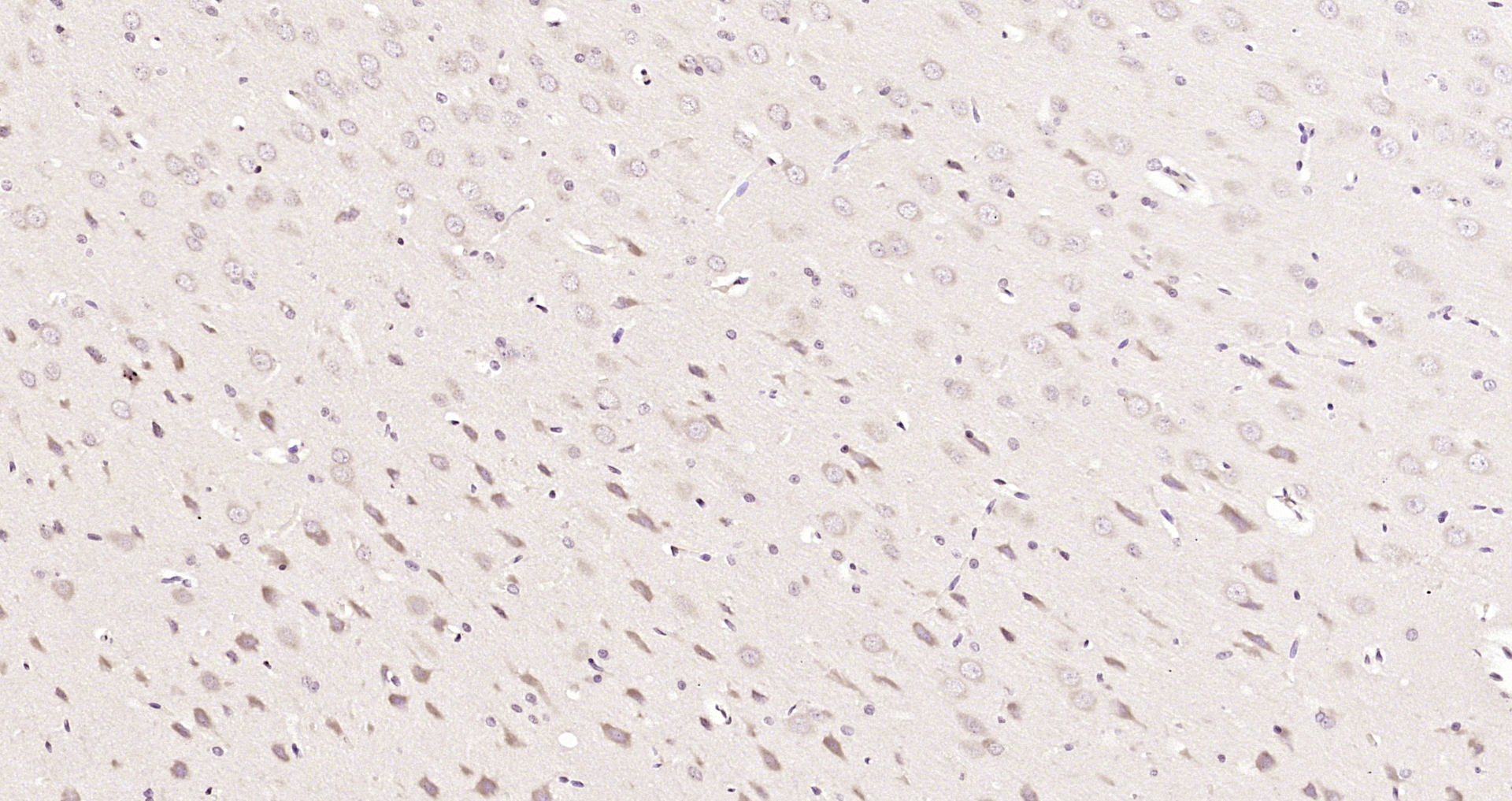 Paraformaldehyde-fixed, paraffin embedded Rat brain; Antigen retrieval by boiling in sodium citrate buffer (pH6.0) for 15min; Block endogenous peroxidase by 3% hydrogen peroxide for 20 minutes; Blocking buffer (normal goat serum) at 37°C for 30min; Antibody incubation with Tollip Polyclonal Antibody, Unconjugated (bs-18168R) at 1:200 overnight at 4°C, DAB staining.