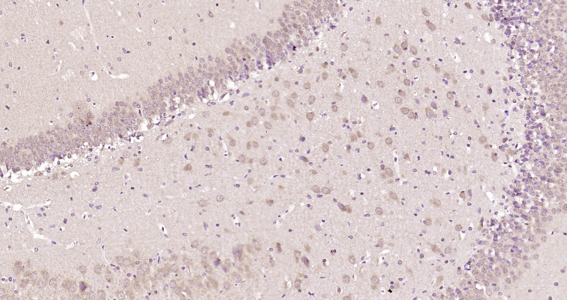 Paraformaldehyde-fixed, paraffin embedded Rat brain; Antigen retrieval by boiling in sodium citrate buffer (pH6.0) for 15min; Block endogenous peroxidase by 3% hydrogen peroxide for 20 minutes; Blocking buffer (normal goat serum) at 37°C for 30min; Antibody incubation with LNX1 Polyclonal Antibody, Unconjugated (bs-18320R) at 1:200 overnight at 4°C, DAB staining.