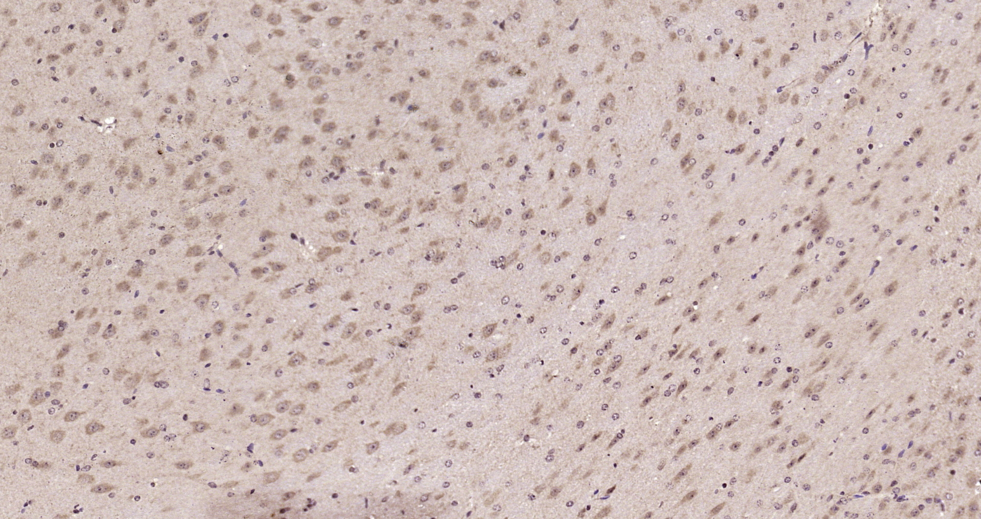 Paraformaldehyde-fixed, paraffin embedded Mouse brain; Antigen retrieval by boiling in sodium citrate buffer (pH6.0) for 15min; Block endogenous peroxidase by 3% hydrogen peroxide for 20 minutes; Blocking buffer (normal goat serum) at 37°C for 30min; Antibody incubation with LNX1 Polyclonal Antibody, Unconjugated (bs-18320R) at 1:200 overnight at 4°C, DAB staining.