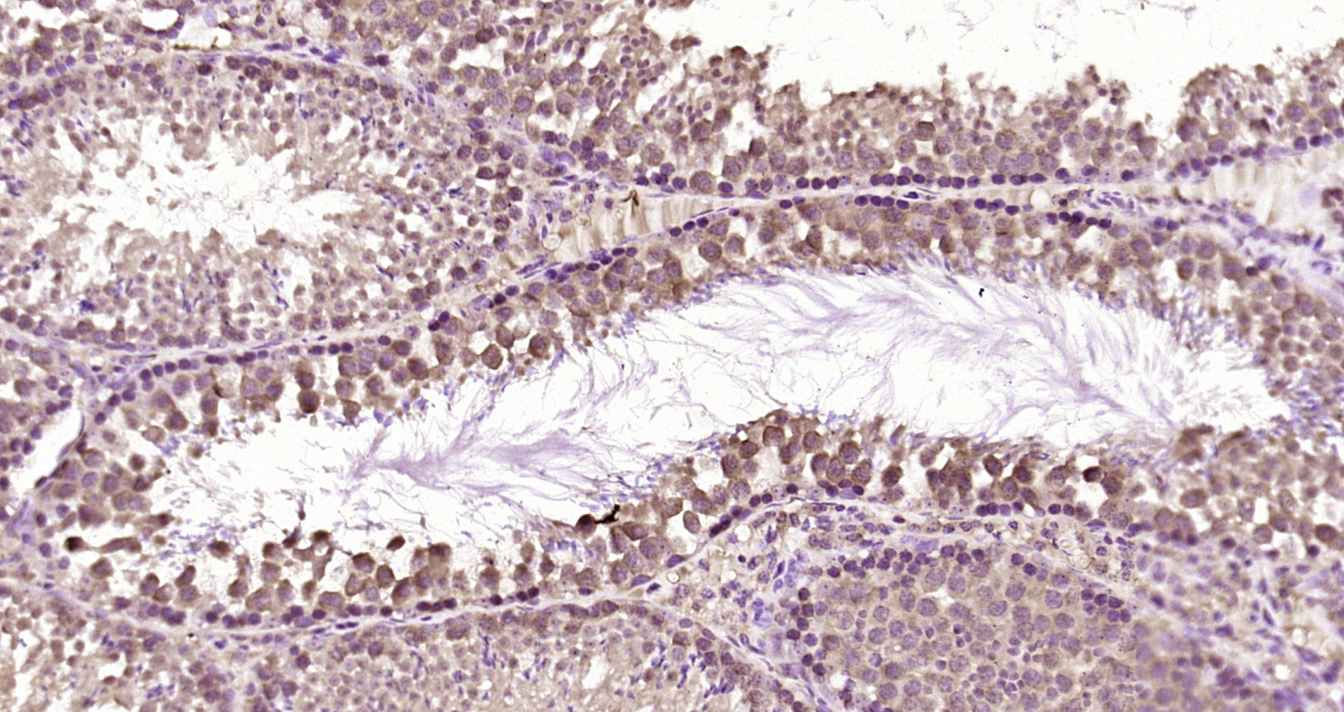Paraformaldehyde-fixed, paraffin embedded Mouse testis; Antigen retrieval by boiling in sodium citrate buffer (pH6.0) for 15min; Block endogenous peroxidase by 3% hydrogen peroxide for 20 minutes; Blocking buffer (normal goat serum) at 37°C for 30min; Antibody incubation with LRGUK Polyclonal Antibody, Unconjugated (bs-18357R) at 1:200 overnight at 4°C, DAB staining.