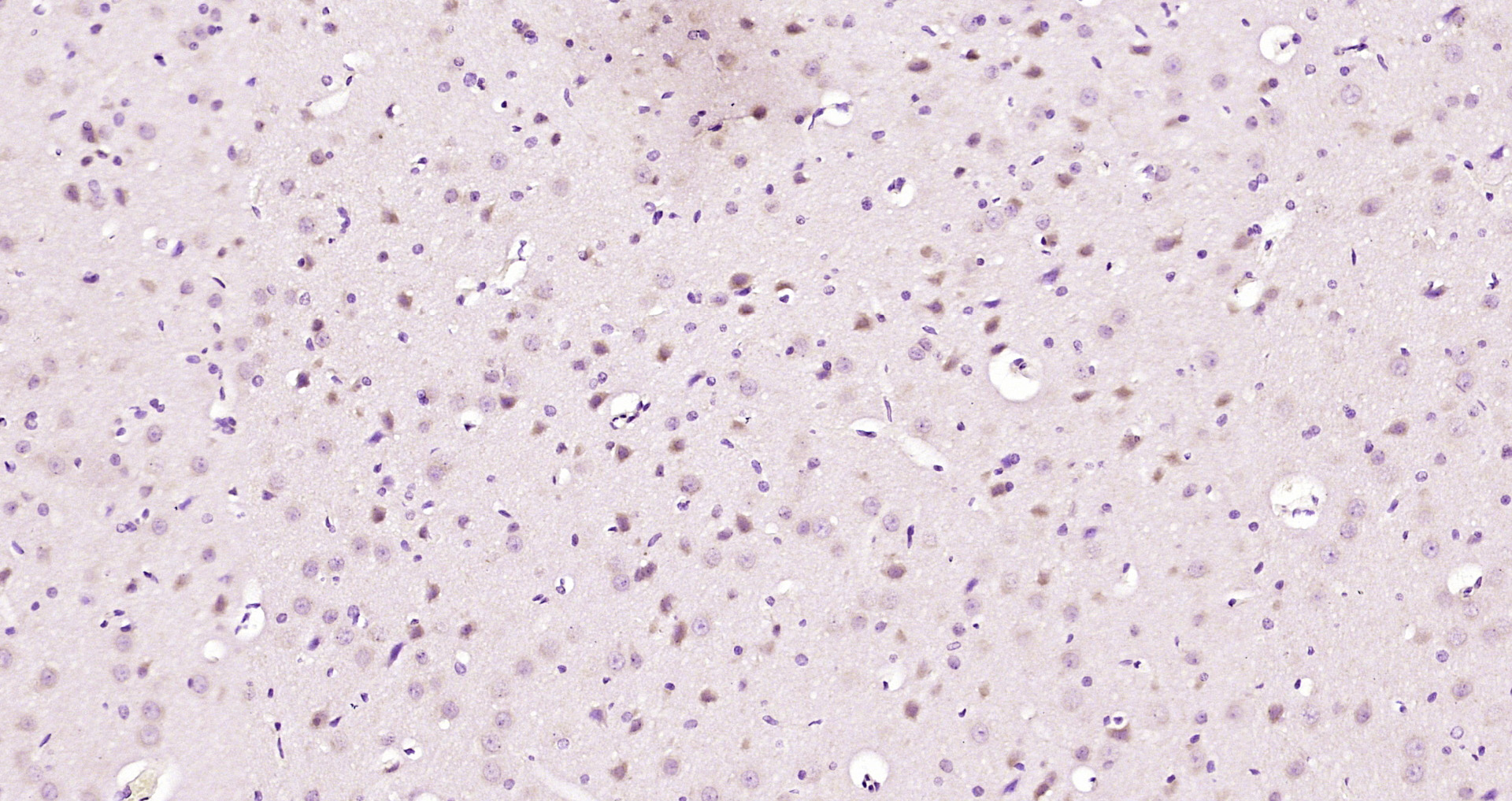 Paraformaldehyde-fixed, paraffin embedded Rat brain; Antigen retrieval by boiling in sodium citrate buffer (pH6.0) for 15min; Block endogenous peroxidase by 3% hydrogen peroxide for 20 minutes; Blocking buffer (normal goat serum) at 37°C for 30min; Antibody incubation with Nesprin 1 Polyclonal Antibody, Unconjugated (bs-19207R) at 1:200 overnight at 4°C, DAB staining.