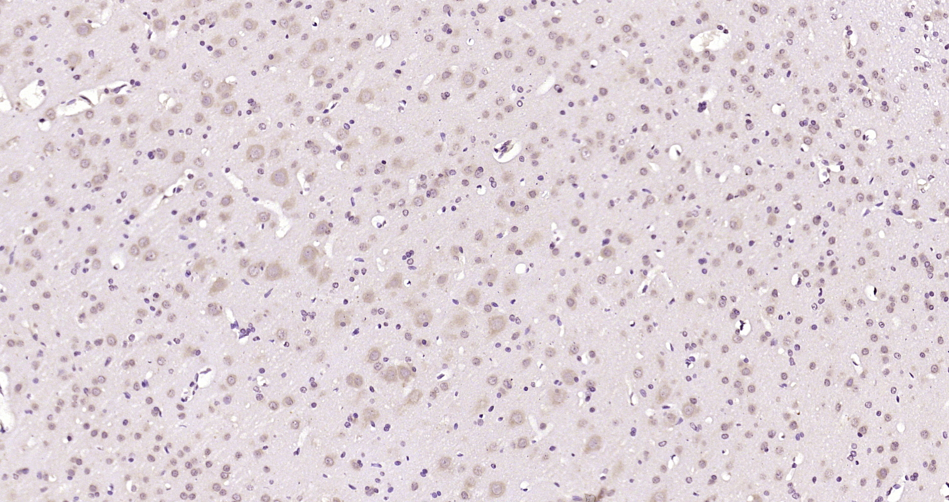 Paraformaldehyde-fixed, paraffin embedded Rat brain; Antigen retrieval by boiling in sodium citrate buffer (pH6.0) for 15min; Block endogenous peroxidase by 3% hydrogen peroxide for 20 minutes; Blocking buffer (normal goat serum) at 37°C for 30min; Antibody incubation with Importin 8 Polyclonal Antibody, Unconjugated (bs-20110R) at 1:200 overnight at 4°C, DAB staining.