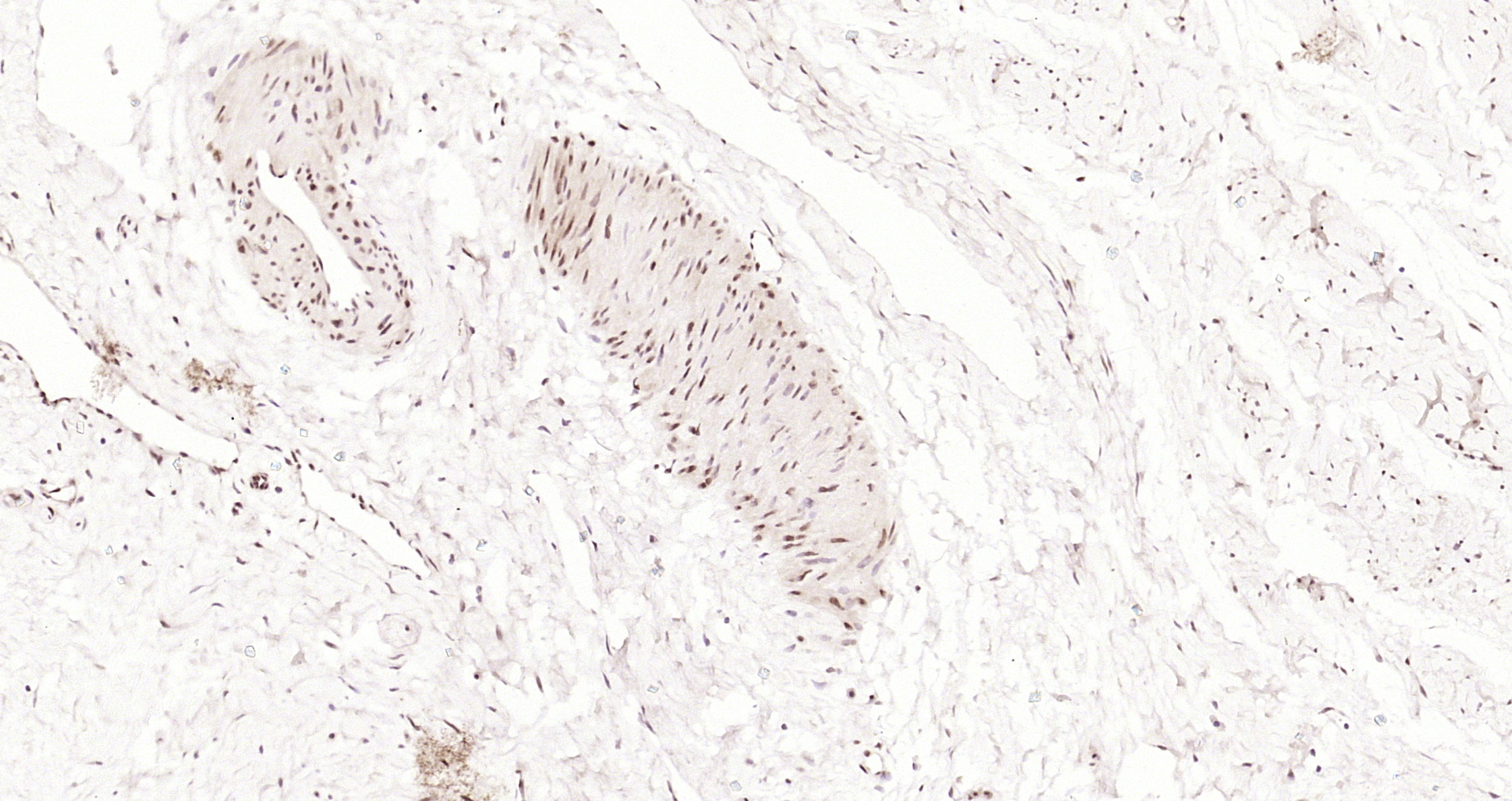 Paraformaldehyde-fixed, paraffin embedded Human uterus; Antigen retrieval by boiling in sodium citrate buffer (pH6.0) for 15min; Block endogenous peroxidase by 3% hydrogen peroxide for 20 minutes; Blocking buffer (normal goat serum) at 37°C for 30min; Antibody incubation with Alx1 Polyclonal Antibody, Unconjugated (bs-20404R) at 1:400 overnight at 4°C, DAB staining.