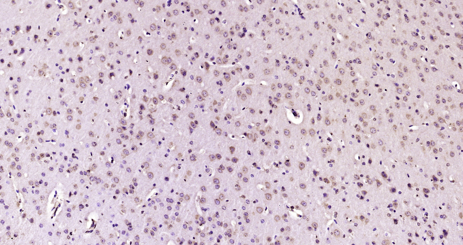 Paraformaldehyde-fixed, paraffin embedded Mouse brain; Antigen retrieval by boiling in sodium citrate buffer (pH6.0) for 15min; Block endogenous peroxidase by 3% hydrogen peroxide for 20 minutes; Blocking buffer (normal goat serum) at 37°C for 30min; Antibody incubation with PAMCI/RASF9 Polyclonal Antibody, Unconjugated (bs-21011R) at 1:200 overnight at 4°C, DAB staining.
