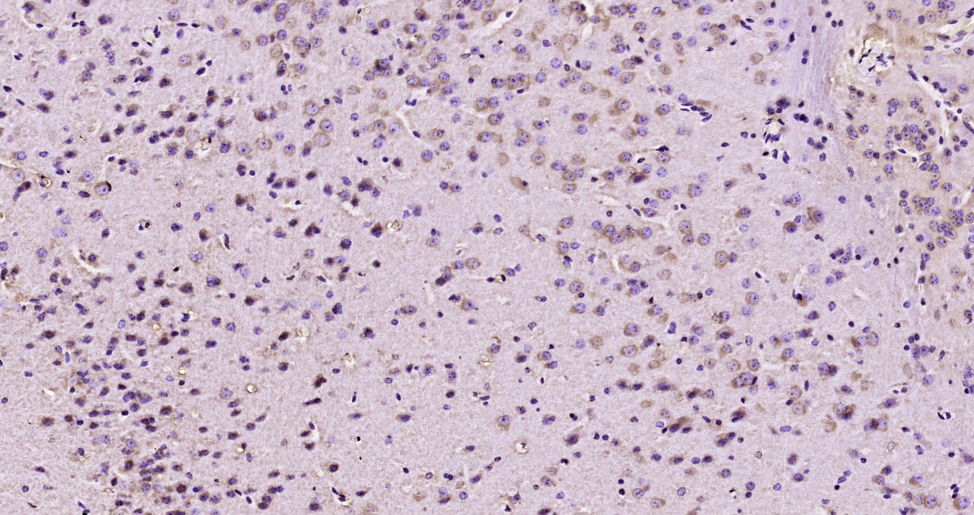 Paraformaldehyde-fixed, paraffin embedded Mouse brain; Antigen retrieval by boiling in sodium citrate buffer (pH6.0) for 15min; Block endogenous peroxidase by 3% hydrogen peroxide for 20 minutes; Blocking buffer (normal goat serum) at 37°C for 30min; Antibody incubation with OPA3 Polyclonal Antibody, Unconjugated (bs-21094R) at 1:200 overnight at 4°C, DAB staining.