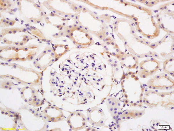 Formalin-fixed and paraffin embedded rat kidney labeled with Anti EIF2AK2/PKR Polyclonal Antibody, Unconjugated (bs-1493R) at 1:200 followed by conjugation to the secondary antibody and DAB staining
