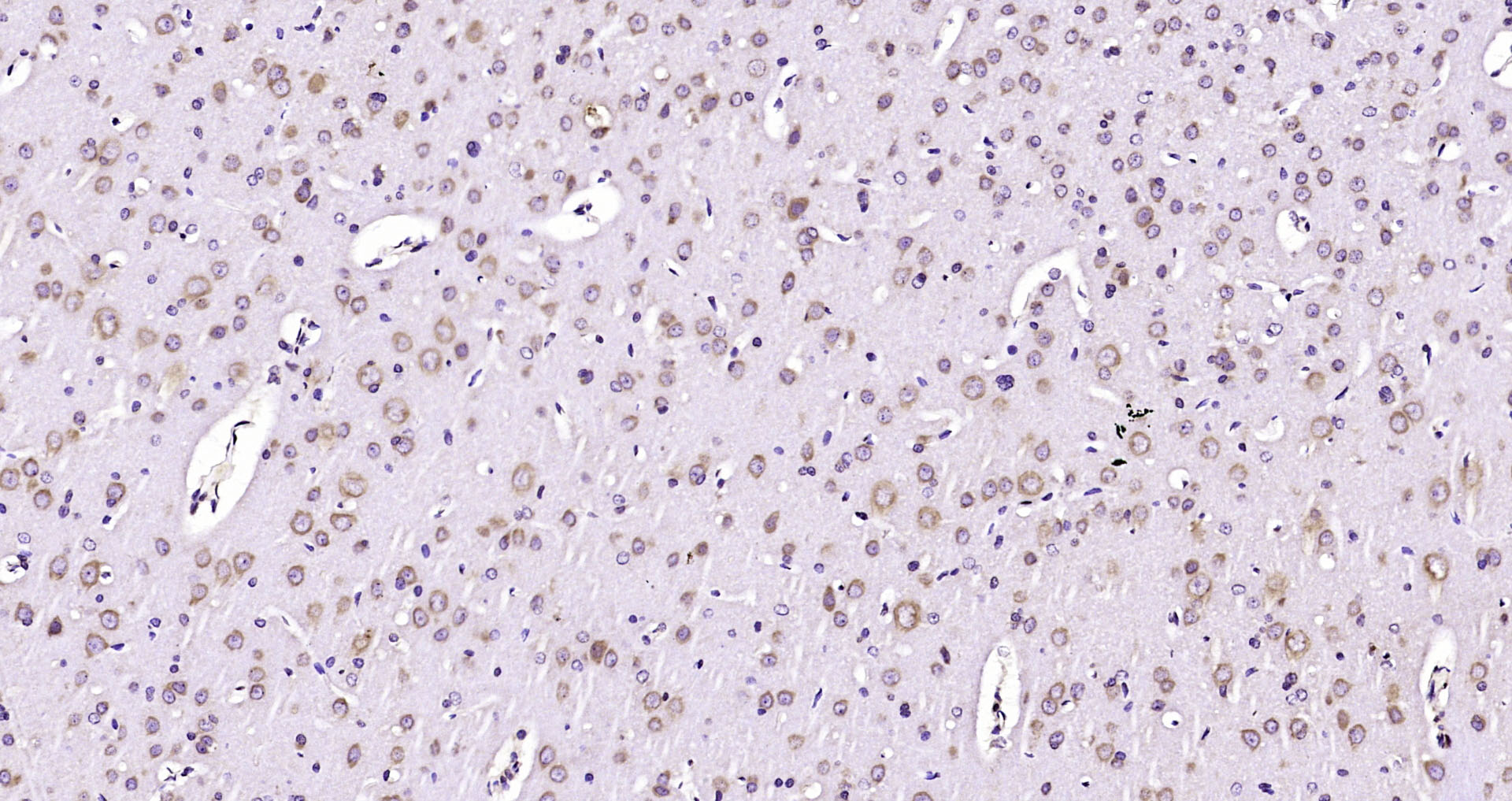Paraformaldehyde-fixed, paraffin embedded Rat brain; Antigen retrieval by boiling in sodium citrate buffer (pH6.0) for 15min; Block endogenous peroxidase by 3% hydrogen peroxide for 20 minutes; Blocking buffer (normal goat serum) at 37°C for 30min; Antibody incubation with Glutathione Reductase Polyclonal Antibody, Unconjugated (bs-21564R) at 1:200 overnight at 4°C, DAB staining.