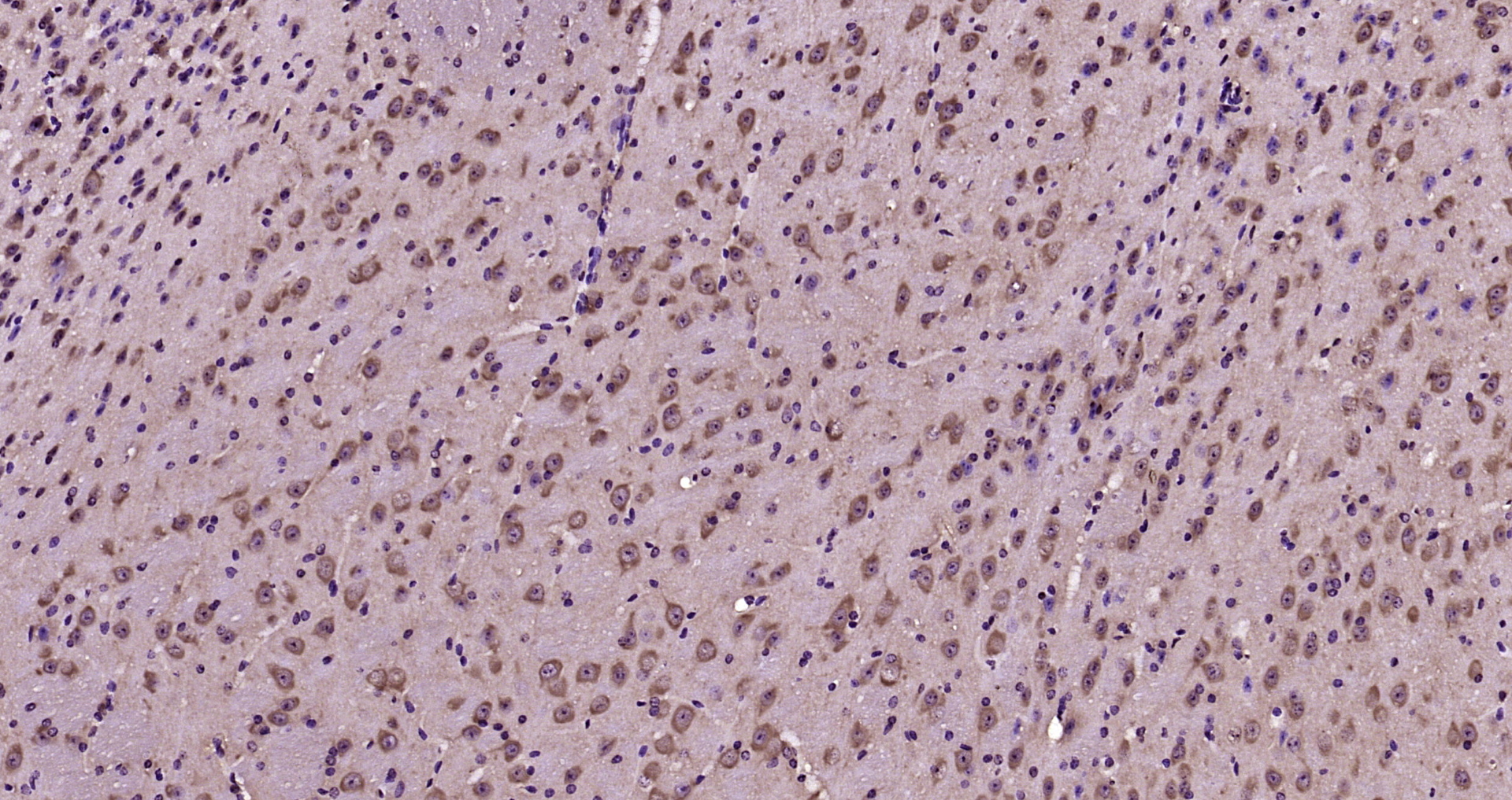 Paraformaldehyde-fixed, paraffin embedded Mouse brain; Antigen retrieval by boiling in sodium citrate buffer (pH6.0) for 15min; Block endogenous peroxidase by 3% hydrogen peroxide for 20 minutes; Blocking buffer (normal goat serum) at 37°C for 30min; Antibody incubation with Notch 2 Polyclonal Antibody, Unconjugated (bs-21663R) at 1:200 overnight at 4°C, DAB staining.
