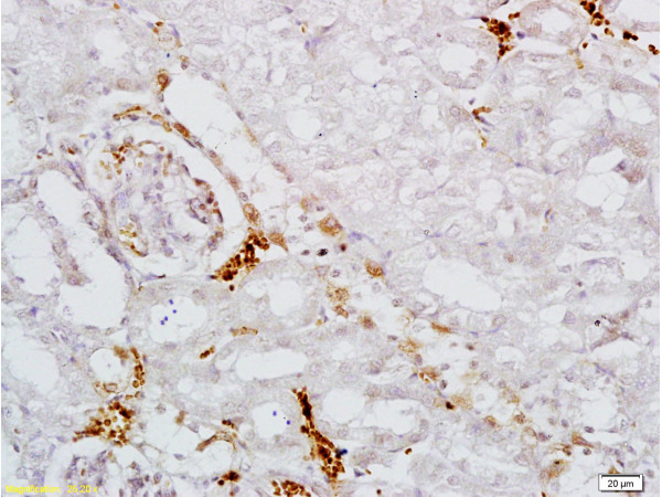 Formalin-fixed and paraffin embedded mouse kidney labeled with Anti AAK1 Polyclonal Antibody, Unconjugated (bs-1507R) at 1:200 followed by conjugation to the secondary antibody and DAB staining
