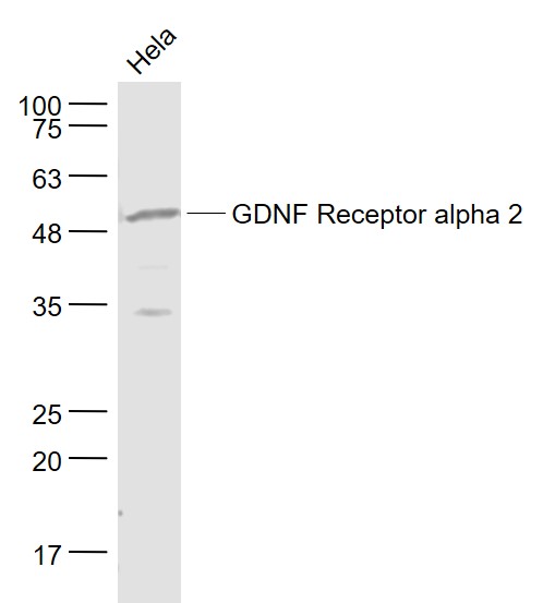 Lane 1: Hela cell lysates probed with GDNF Receptor alpha 2 Polyclonal Antibody, Unconjugated (bs-0054R) at 1:1000 dilution and 4˚C overnight incubation. Followed by conjugated secondary antibody incubation at 1:20000 for 60 min at 37˚C.