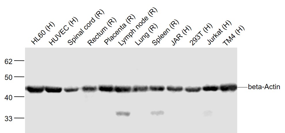 Lane 1: Human HL60 cell lysates; Lane 2: Human HUVEC cell lysates; Lane 3: Rat Spinal cord lysates; Lane 4: Rat Rectum lysates ; Lane 5: Rat Placenta lysates; Lane 6: Rat Lymph node lysates; Lane 7: Rat Lung lysates; Lane 8: Rat Spleen lysates; Lane 9: Human JAR cell lysates; Lane 10: Human 293T cell lysates; Lane 11: Human Jurkat cell lysates ; Lane 12: Human TM4 cell lysates probed with beta Actin Polyclonal Antibody, Unconjugated (bs-0061R) at 1:2000 dilution and 4˚C overnight incubation. Followed by conjugated secondary antibody incubation at 1:20000 for 60 min at 37˚C.