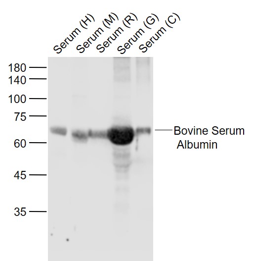 Lane 1: Human Serum lysates; Lane 2: Mouse Serum lysates; Lane 3: Rat Serum lysates; Lane 4: Goat Serum lysates; Lane 5: Cow Serum lysates probed with BSA Polyclonal Antibody, Unconjugated (bs-0292R) at 1:1000 dilution and 4˚C overnight incubation. Followed by conjugated secondary antibody incubation at 1:20000 for 60 min at 37˚C.