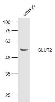 Lane 1: Mouse embyo lysates probed with GLUT2 Polyclonal Antibody, Unconjugated (bs-0351R) at 1:300 dilution and 4˚C overnight incubation. Followed by conjugated secondary antibody incubation at 1:20000 for 60 min at 37˚C.