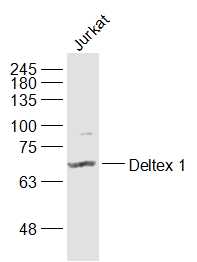 Lane 1: Jurkat cell lysates probed with Deltex 1 Polyclonal Antibody, Unconjugated (bs-0399R) at 1:1000 dilution and 4˚C overnight incubation. Followed by conjugated secondary antibody incubation at 1:20000 for 60 min at 37˚C.