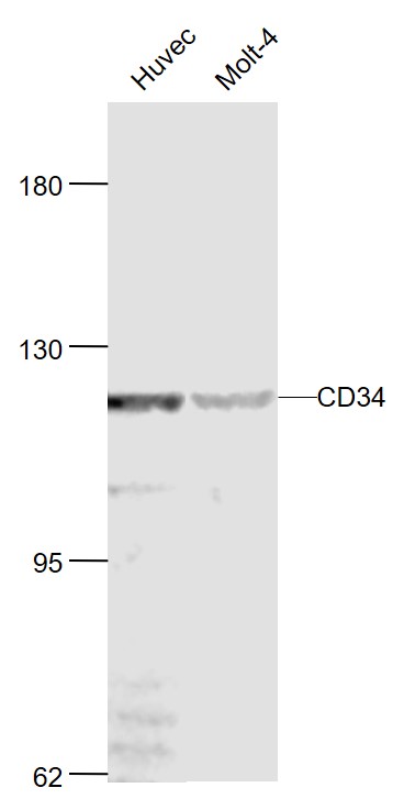 Lane 1: Huvec cell lysates; Lane 2: Molt-4 cell lysates probed with CD34 Polyclonal Antibody, Unconjugated (bs-0646R) at 1:1000 dilution and 4˚C overnight incubation. Followed by conjugated secondary antibody incubation at 1:20000 for 60 min at 37˚C.