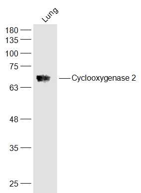 Lane 1: Mouse Lung lysates probed with Cyclooxygenase 2 Polyclonal Antibody, Unconjugated (bs-0732R) at 1:300 dilution and 4˚C overnight incubation. Followed by conjugated secondary antibody incubation at 1:20000 for 60 min at 37˚C.