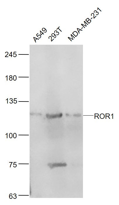 Lane 1:A549 cell lysates; Lane 2: 293T cell lysates; Lane 3: MDA-MB-231 cell lysates probed with ROR1 Polyclonal Antibody, Unconjugated (bs-10076R) at 1:1000 dilution and 4˚C overnight incubation. Followed by conjugated secondary antibody incubation at 1:20000 for 60 min at 37˚C.