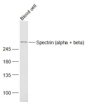 Lane 1: Mouse Blood cell lysates probed with Spectrin Polyclonal Antibody, Unconjugated (bs-10190R) at 1:1000 dilution and 4˚C overnight incubation. Followed by conjugated secondary antibody incubation at 1:20000 for 60 min at 37˚C.