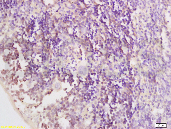 Formalin-fixed and paraffin embedded mouse spleen tissue labeled with Anti CCR6/CD196 Polyclonal Antibody, Unconjugated (bs-1542R) at 1:200 followed by conjugation to the secondary antibody and DAB staining