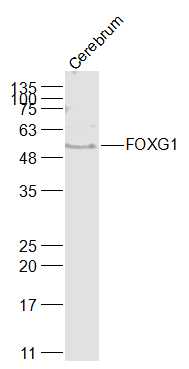 Lane 1: Rat Cerebrum lysates probed with FOXG1 Polyclonal Antibody, Unconjugated (bs-11557R) at 1:1000 dilution and 4˚C overnight incubation. Followed by conjugated secondary antibody incubation at 1:20000 for 60 min at 37˚C.