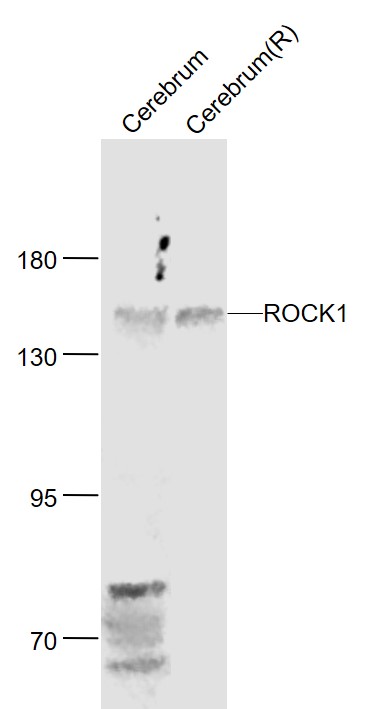Lane 1: Mouse Cerebrum lysates; Lane 2: Rat Cerebrum lysates probed with ROCK1 Polyclonal Antibody, Unconjugated (bs-1166R) at 1:300 dilution and 4˚C overnight incubation. Followed by conjugated secondary antibody incubation at 1:20000 for 60 min at 37˚C.