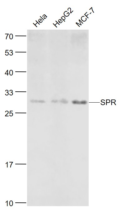 Lane 1: Hela cell lysates; Lane 2: HepG2 cell lysates; Lane 3: MCF-7 cell lysates probed with SPR Polyclonal Antibody, Unconjugated (bs-11784R) at 1:1000 dilution and 4˚C overnight incubation. Followed by conjugated secondary antibody incubation at 1:20000 for 60 min at 37˚C.