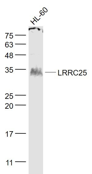 Lane 1: HL60 cell lysates probed with LRRC25 Polyclonal Antibody, Unconjugated (bs-12339R) at 1:1000 dilution and 4˚C overnight incubation. Followed by conjugated secondary antibody incubation at 1:20000 for 60 min at 37˚C.