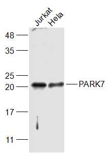 Lane 1: Jurkat cell lysates; Lane 2: Hela cell lysates probed with PARK7 Polyclonal Antibody, Unconjugated (bs-1306R) at 1:1000 dilution and 4˚C overnight incubation. Followed by conjugated secondary antibody incubation at 1:20000 for 60 min at 37˚C.