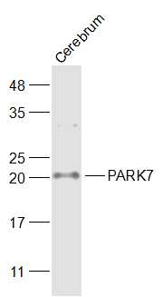 Lane 1: Mouse Cerebrum lysates probed with PARK7 Polyclonal Antibody, Unconjugated (bs-1306R) at 1:1000 dilution and 4˚C overnight incubation. Followed by conjugated secondary antibody incubation at 1:20000 for 60 min at 37˚C.
