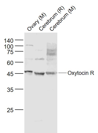 Lane 1: Mouse Ovary lysates; Lane 2: Rat Cerebrum lysates; Lane 3: Mouse Cerebrum lysates probed with Oxytocin R Polyclonal Antibody, Unconjugated (bs-1314R) at 1:1000 dilution and 4˚C overnight incubation. Followed by conjugated secondary antibody incubation at 1:20000 for 60 min at 37˚C.