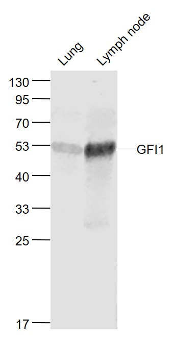 Lane 1: Mouse Lung lysates; Lane 2: Mouse Lymph node lysates probed with GFI1/ZNF163 Polyclonal Antibody, Unconjugated (bs-13337R) at 1:1000 dilution and 4˚C overnight incubation. Followed by conjugated secondary antibody incubation at 1:20000 for 60 min at 37˚C.