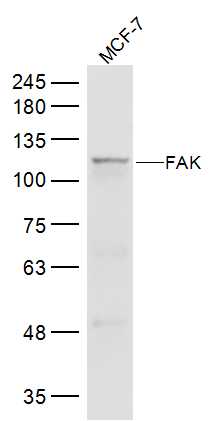Lane 1: MCF-7 cell lysates probed with FAK Polyclonal Antibody, Unconjugated (bs-1340R) at 1:300 dilution and 4˚C overnight incubation. Followed by conjugated secondary antibody incubation at 1:20000 for 60 min at 37˚C.