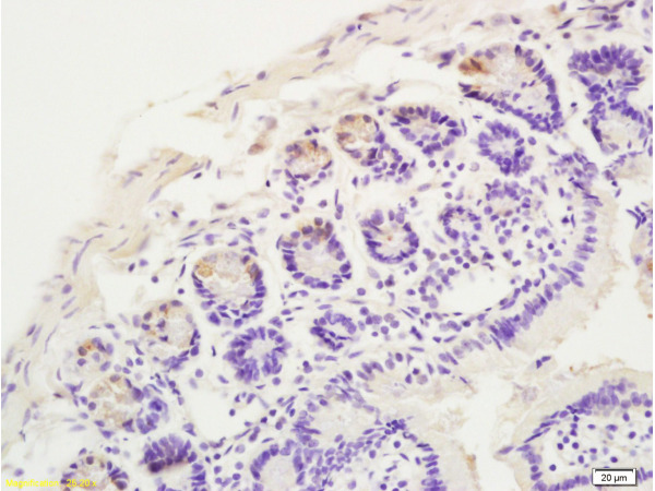 Formalin-fixed and paraffin embedded rat intestine labeled with Anti CCR10 Polyclonal Antibody, Unconjugated (bs-1710R) at 1:200 followed by conjugation to the secondary antibody and DAB staining