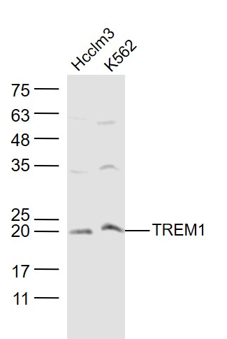 Lane 1: Hcclm3 cell lysates; Lane 2: K562 cell lysates probed with TREM1 Polyclonal Antibody, Unconjugated (bs-10306R) at 1:300 dilution and 4˚C overnight incubation. Followed by conjugated secondary antibody incubation at 1:20000 for 60 min at 37˚C.