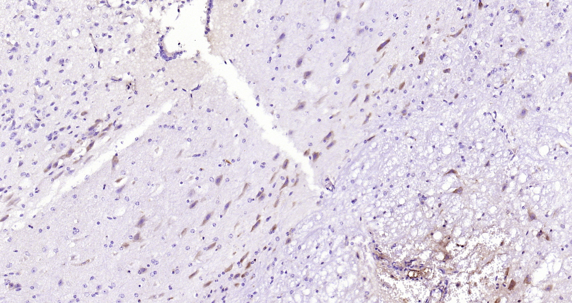 Paraformaldehyde-fixed, paraffin embedded Mouse cerebellum; Antigen retrieval by boiling in sodium citrate buffer (pH6.0) for 15min; Block endogenous peroxidase by 3% hydrogen peroxide for 20 minutes; Blocking buffer (normal goat serum) at 37°C for 30min; Antibody incubation with NSE (15E2) Monoclonal Antibody, Unconjugated (bsm-33072M) at 1:200 overnight at 4°C, DAB staining.