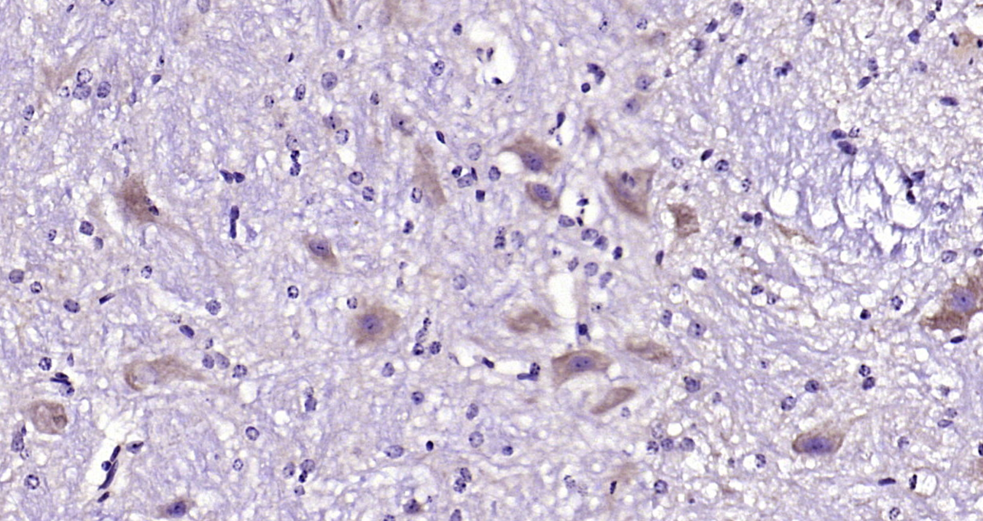 Paraformaldehyde-fixed, paraffin embedded Mouse cerebellum; Antigen retrieval by boiling in sodium citrate buffer (pH6.0) for 15min; Block endogenous peroxidase by 3% hydrogen peroxide for 20 minutes; Blocking buffer (normal goat serum) at 37°C for 30min; Antibody incubation with Fibronectin Polyclonal Antibody, Unconjugated (bs-0666R) at 1:200 overnight at 4°C, DAB staining.