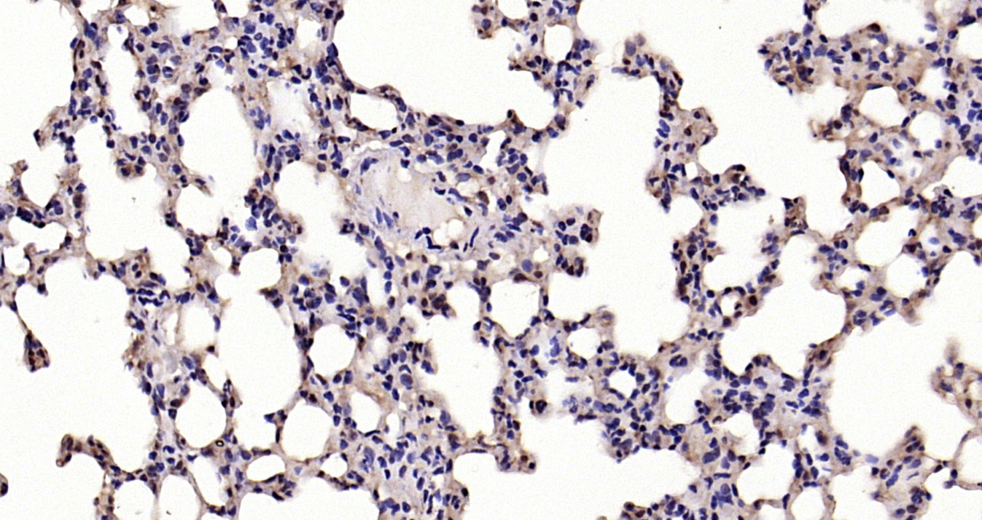 Paraformaldehyde-fixed, paraffin embedded Mouse lung; Antigen retrieval by boiling in sodium citrate buffer (pH6.0) for 15min; Block endogenous peroxidase by 3% hydrogen peroxide for 20 minutes; Blocking buffer (normal goat serum) at 37°C for 30min; Antibody incubation with NFKBIA/IKB alpha Polyclonal Antibody, Unconjugated (bs-1287R) at 1:200 overnight at 4°C, DAB staining.