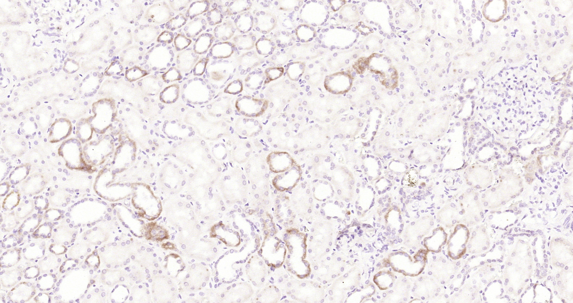 Paraformaldehyde-fixed, paraffin embedded Human kidney; Antigen retrieval by boiling in sodium citrate buffer (pH6.0) for 15min; Block endogenous peroxidase by 3% hydrogen peroxide for 20 minutes; Blocking buffer (normal goat serum) at 37°C for 30min; Antibody incubation with Clathrin heavy chain Polyclonal Antibody, Unconjugated (bs-21805R) at 1:200 overnight at 4°C, DAB staining.